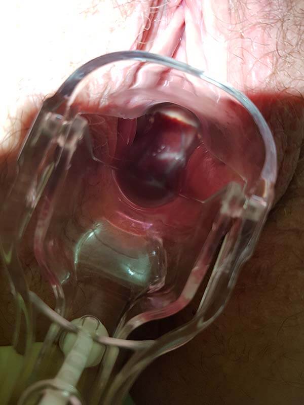 гнойные выделения выделения из половых органов