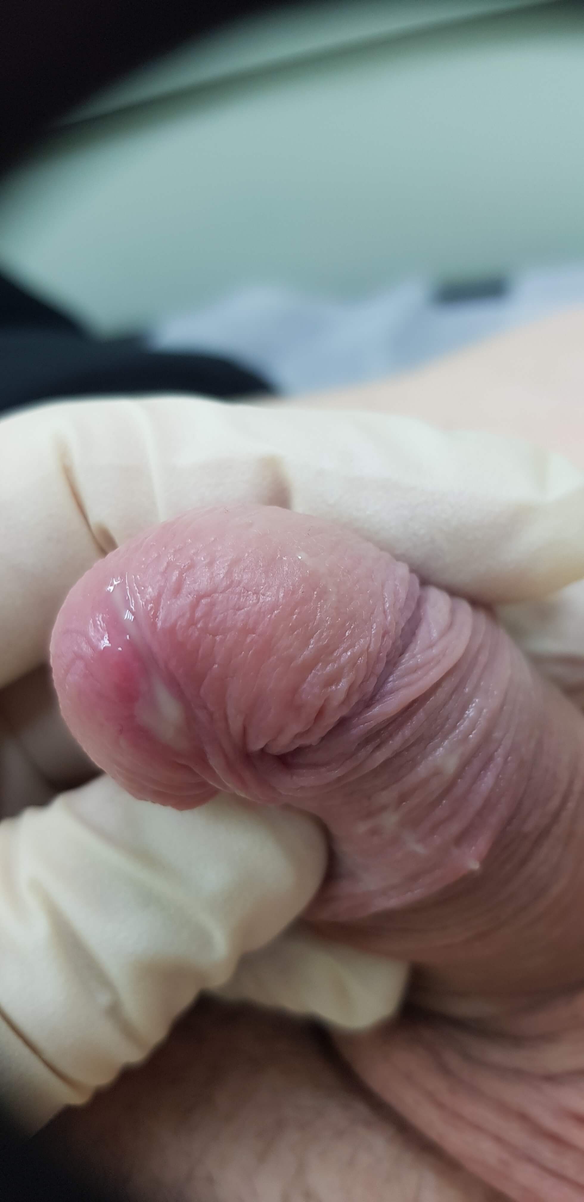 Возбудители ЗППП