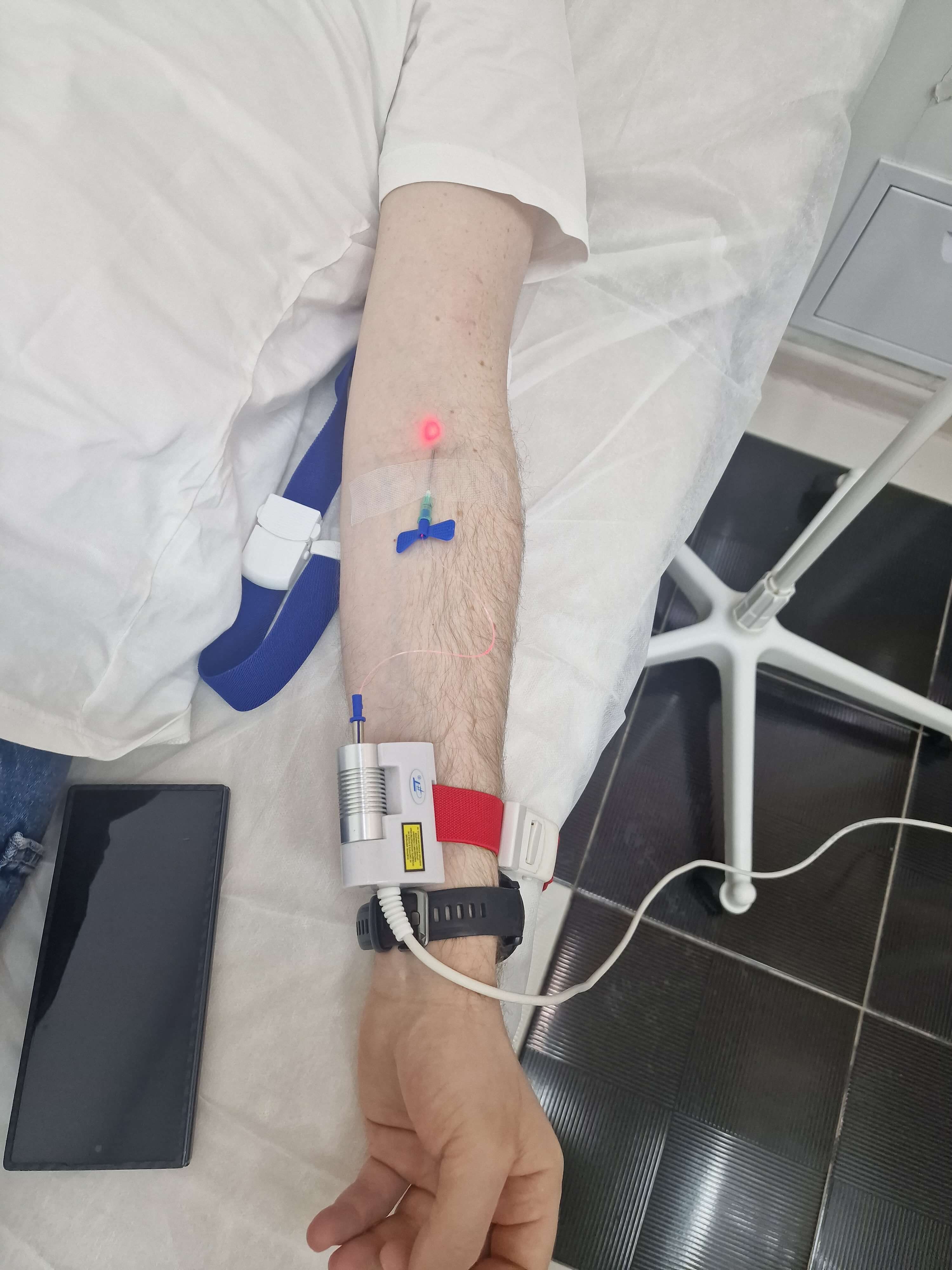 облучение крови лазером