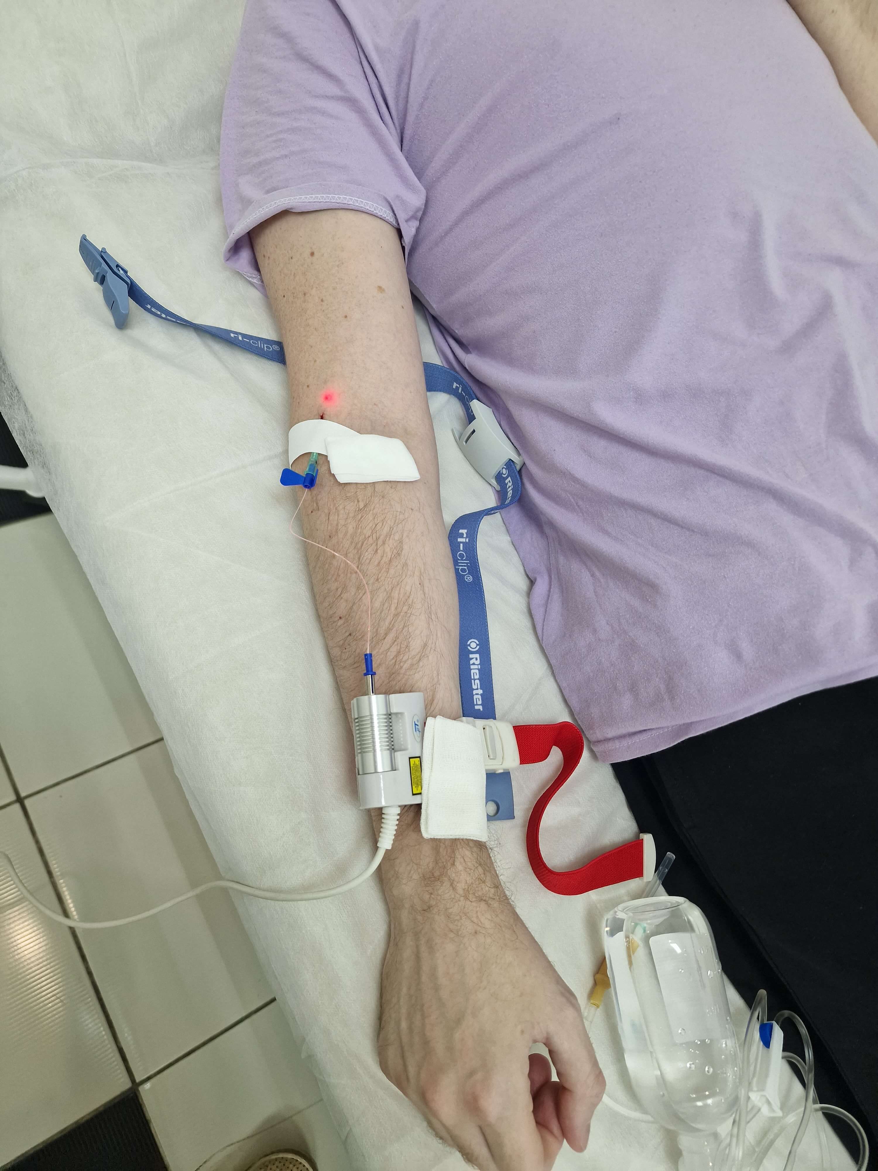 внутривенное лазерное облучение крови