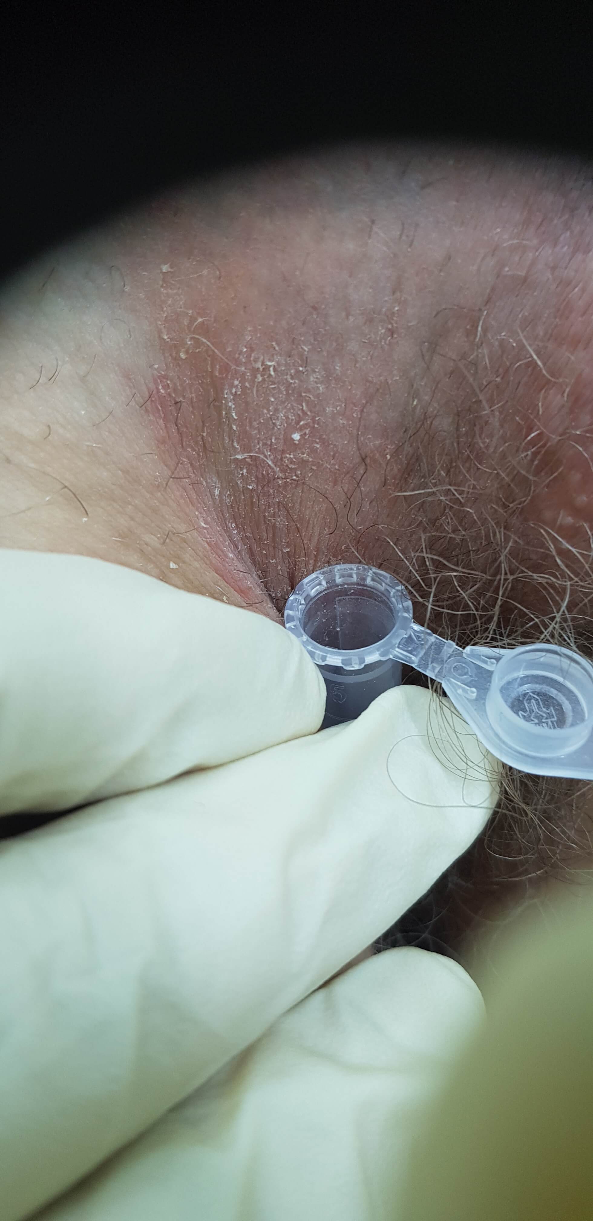 Микроскопия с КОН