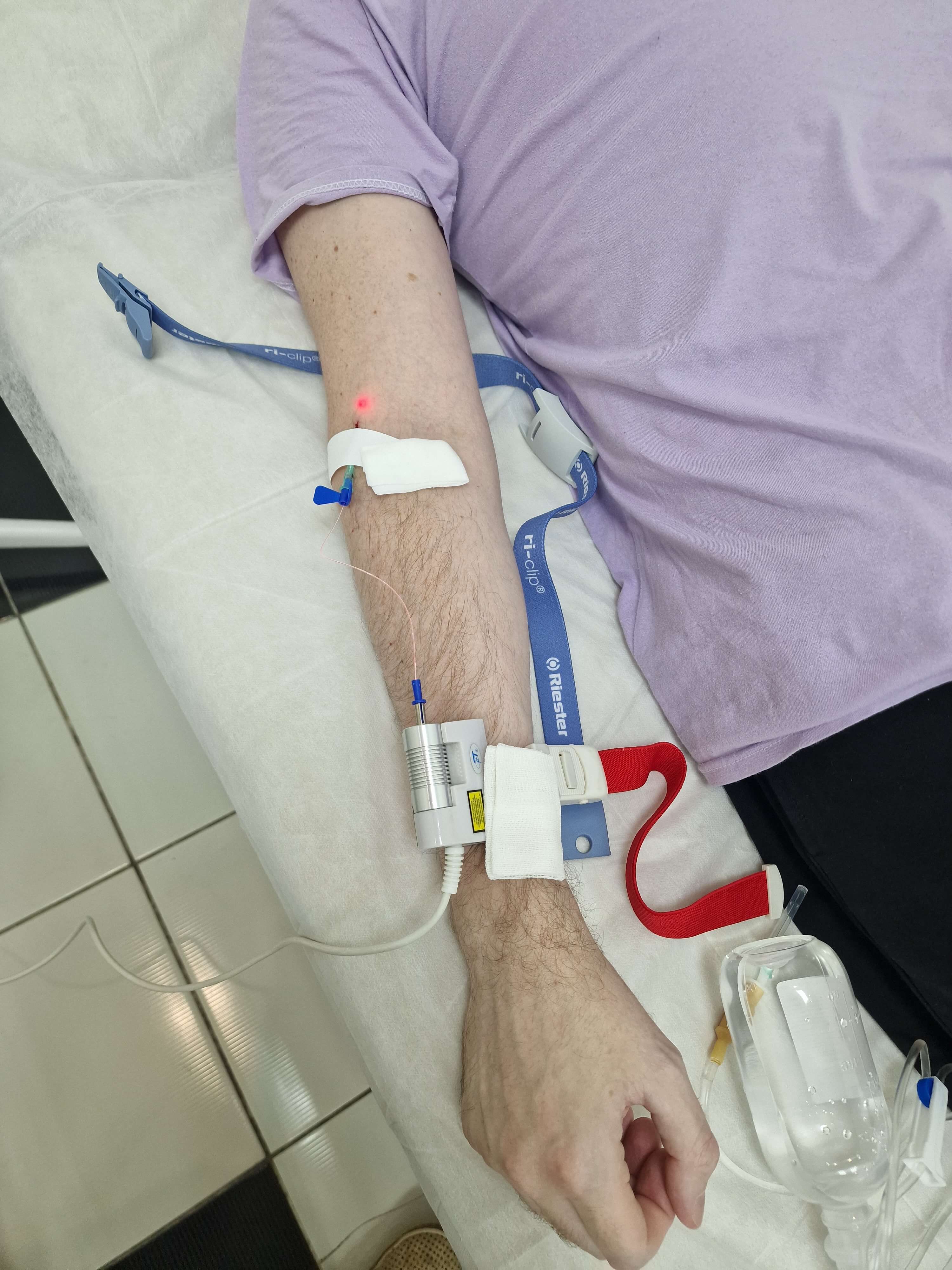 ультрафиолетовое облучение крови