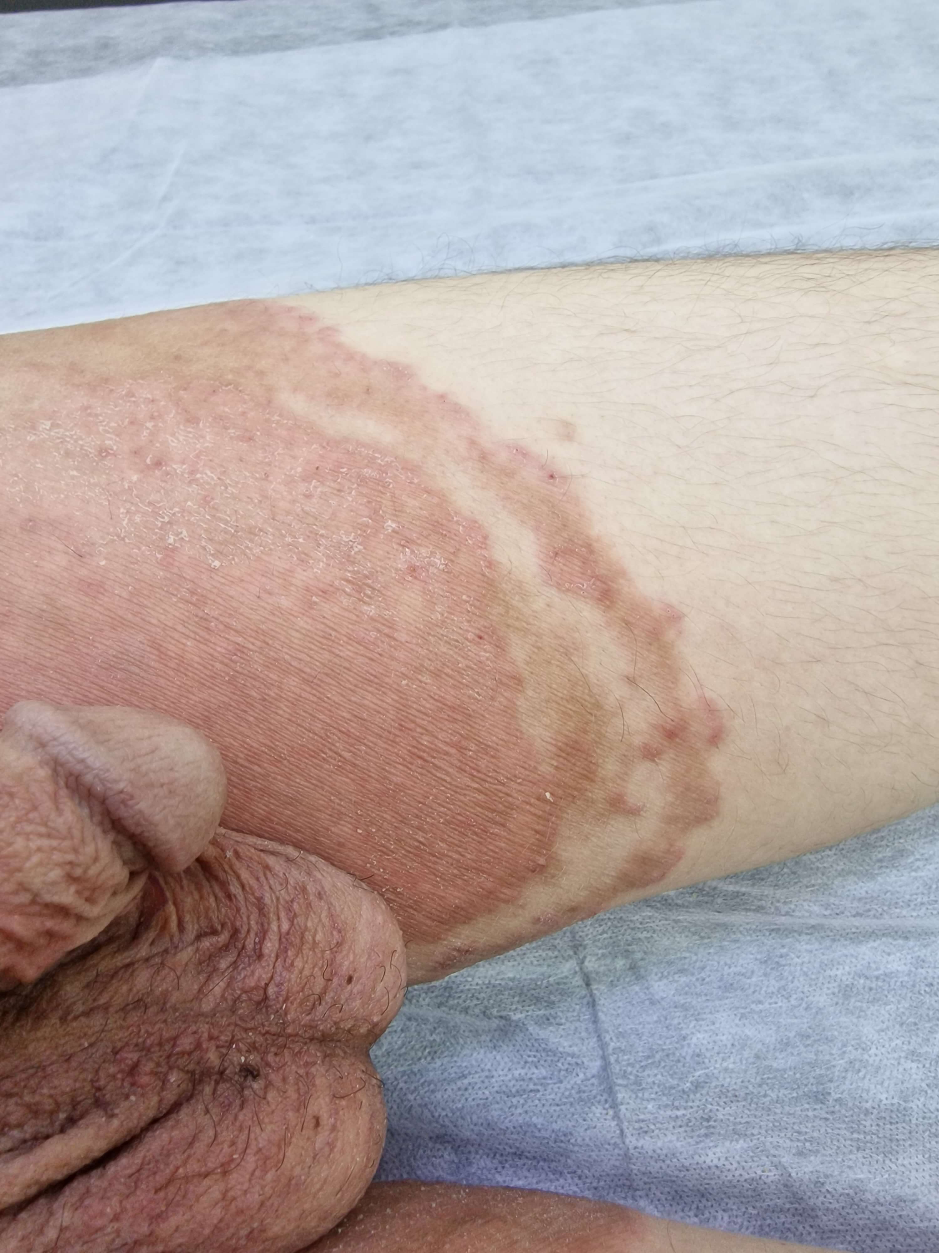 прием миколога по результатам посева на грибки в Москве