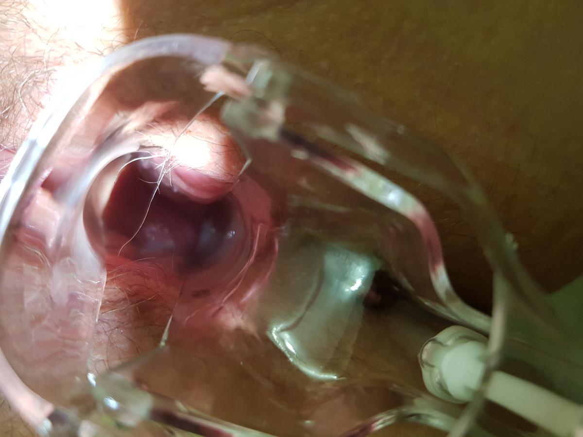 Сдача анализов на ИППП