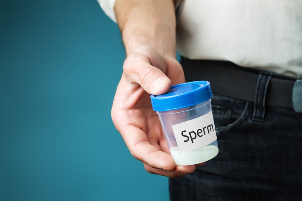 Сперма в контейнере для спермограммы