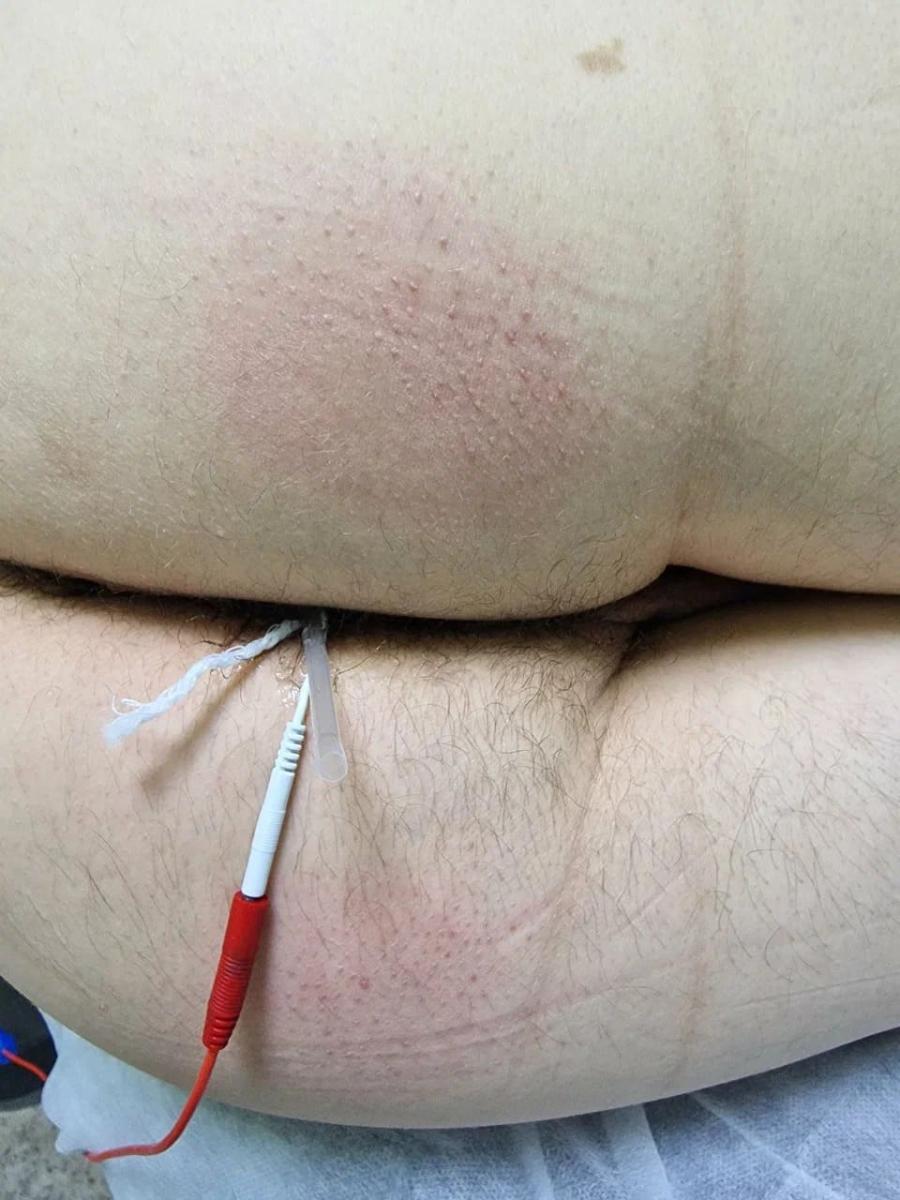 электрофорез