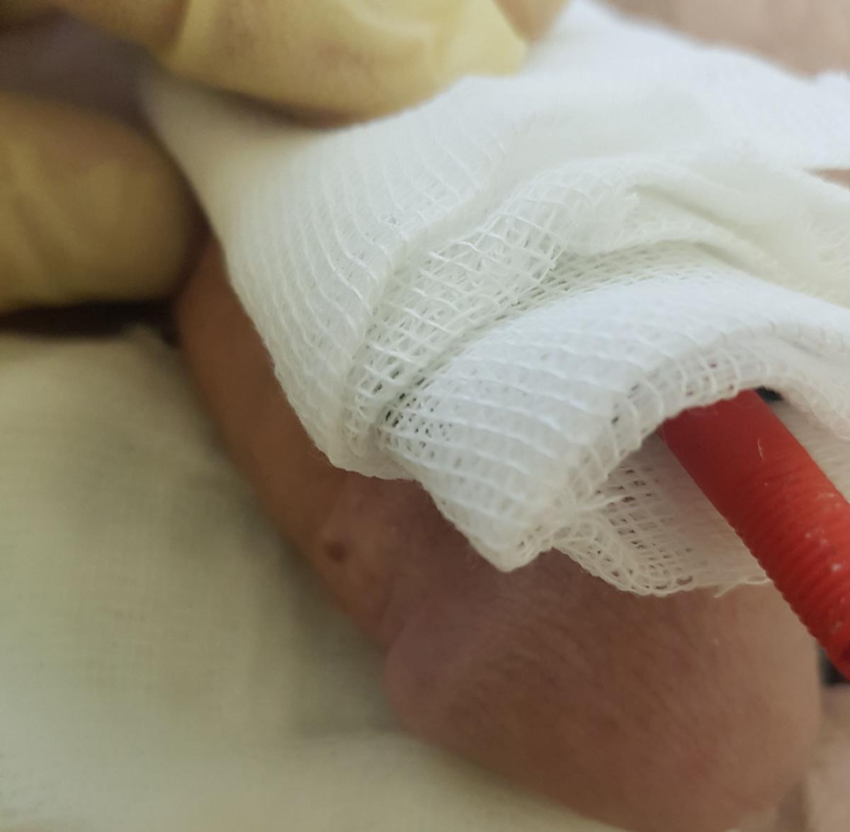 электрофорез препаратов