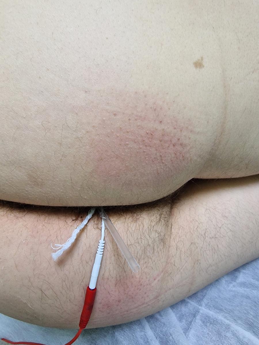 электрофорез с лекарством электрофорез