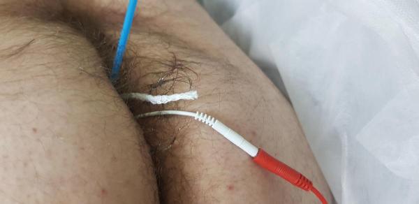 электрофорез