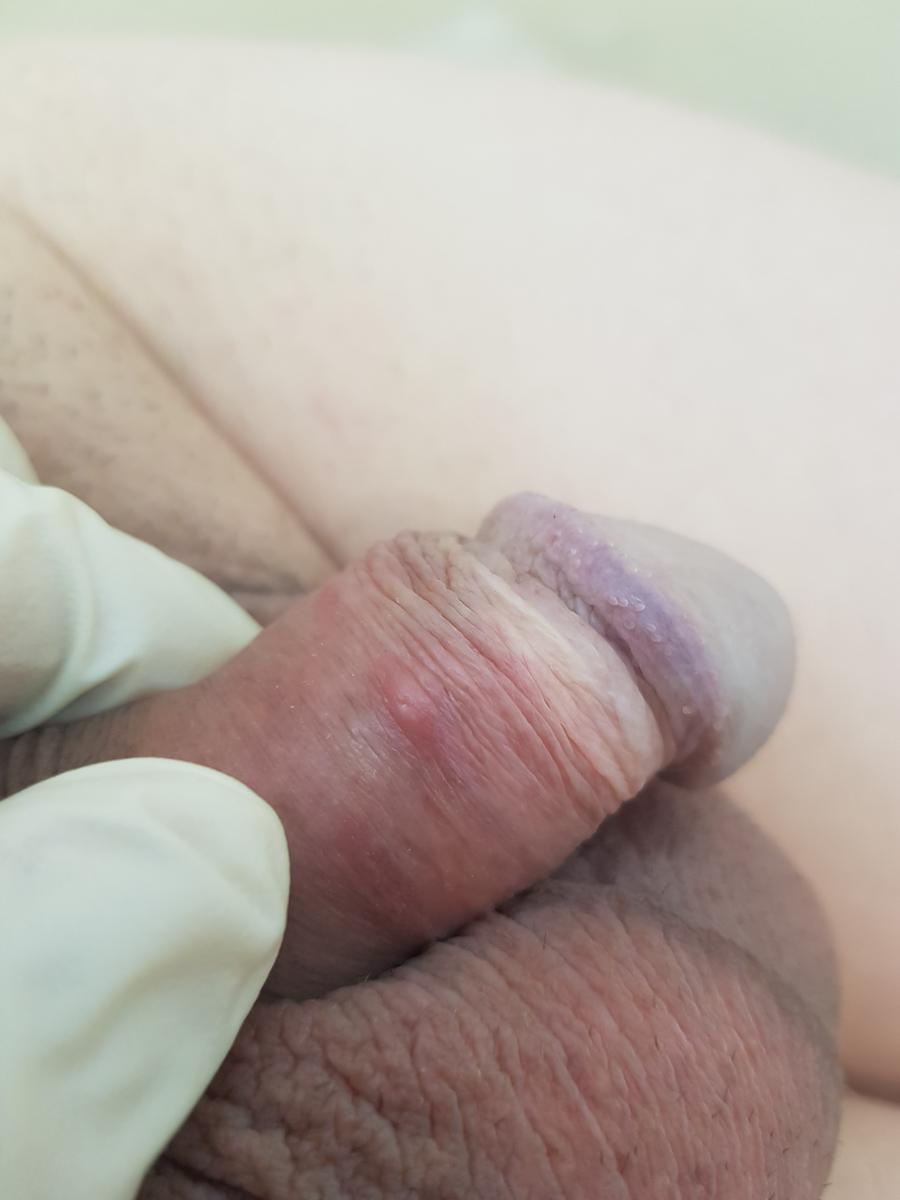 половые болезни мастурбация фото 3