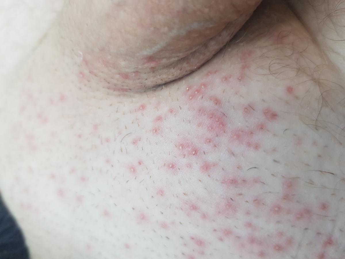 после бритья