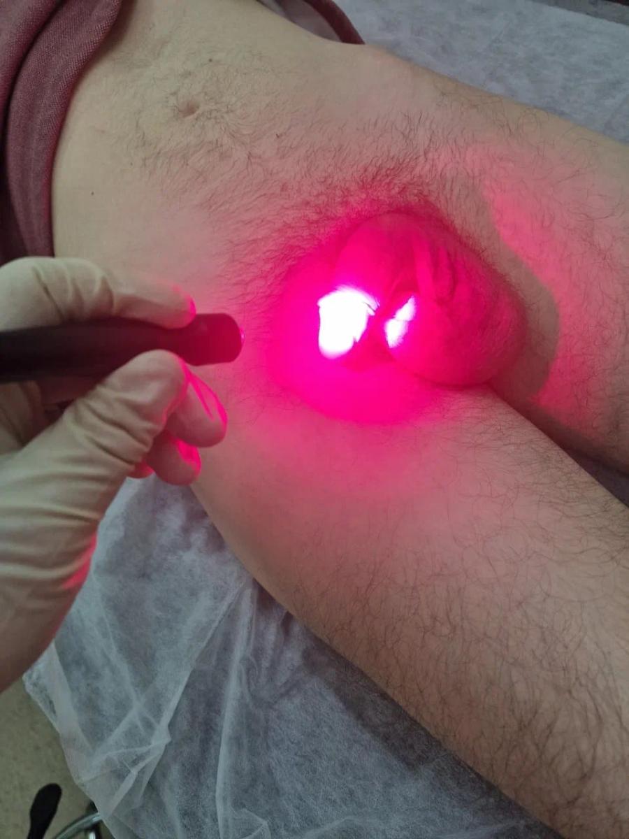 Фотодинамическая терапия