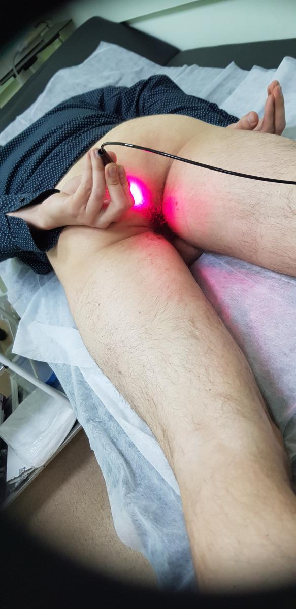 фотодинамическая терапия фотодинамика