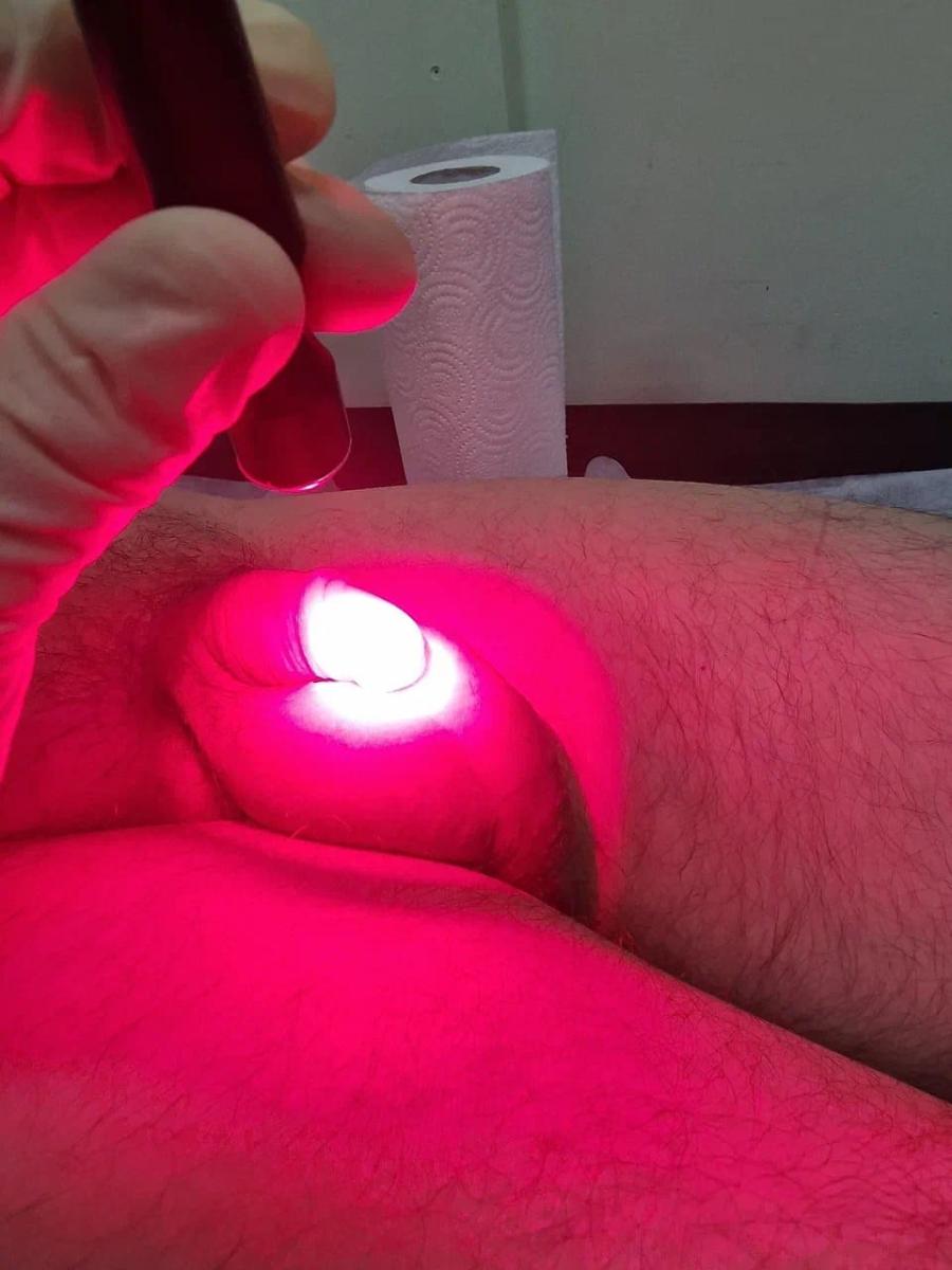 фотодинамический лазер