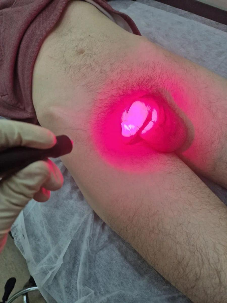 фотодинамический лазер фотодинамический лазер