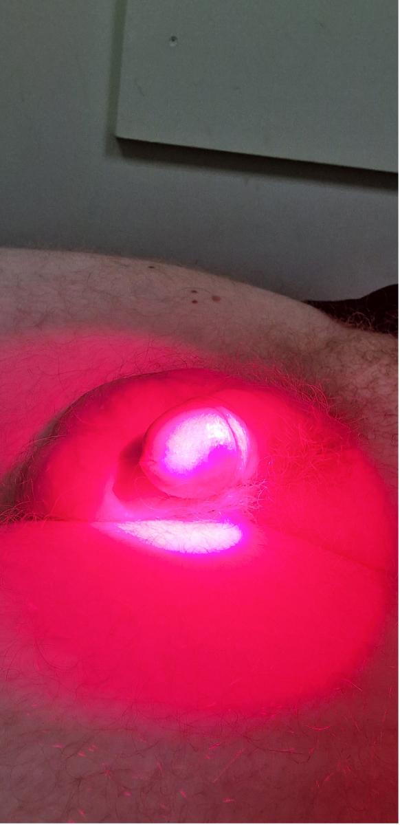 фотодинамика