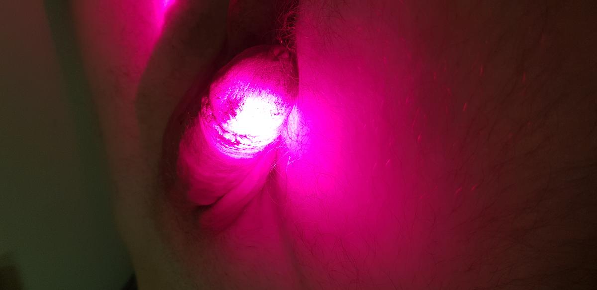 фотодинамическая терапия головки фотодинамика