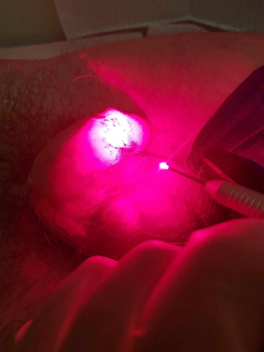 фотодинамика