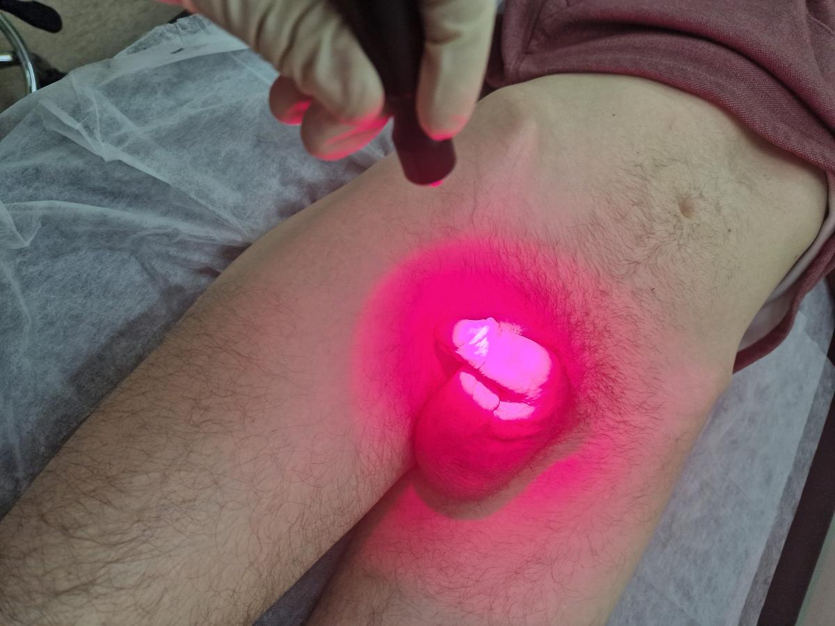 фотодинамическая терапия фтд