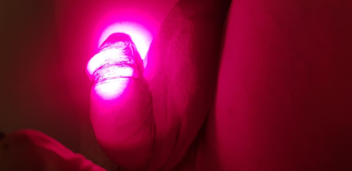 фотодинамика