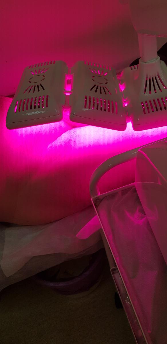 фотодинамическая терапия фтд