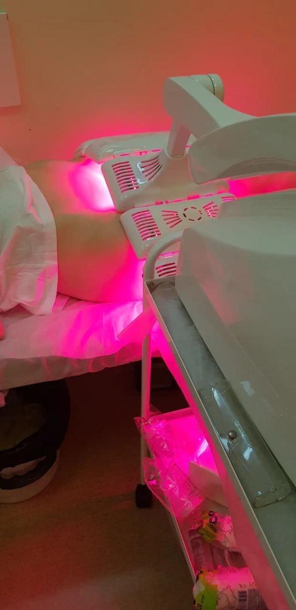 фотодинамическая терапия грибков в паху