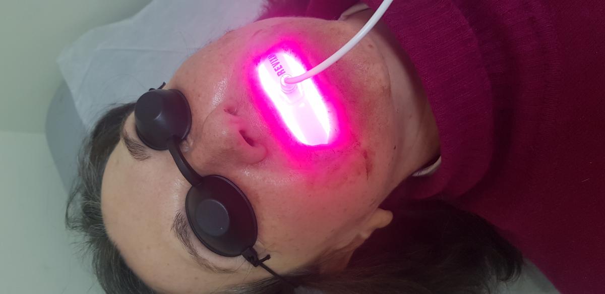 фотодинамическая терапия фтд