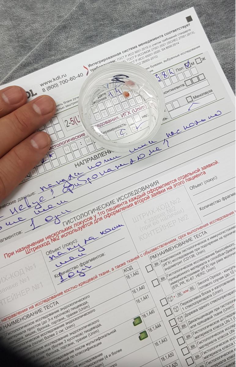 Гистологическре заключение после удаления образования аппаратом ургитрон гистология