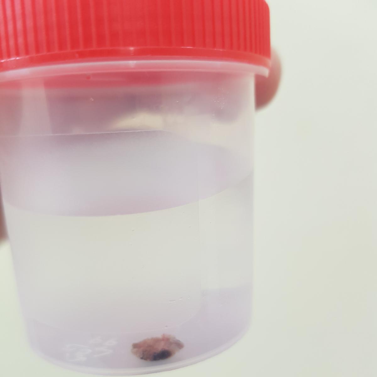 гистологическое исследование гистология родинки