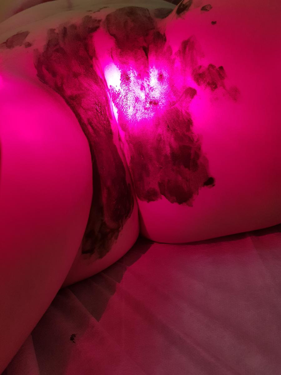 фотосенсибилизатор