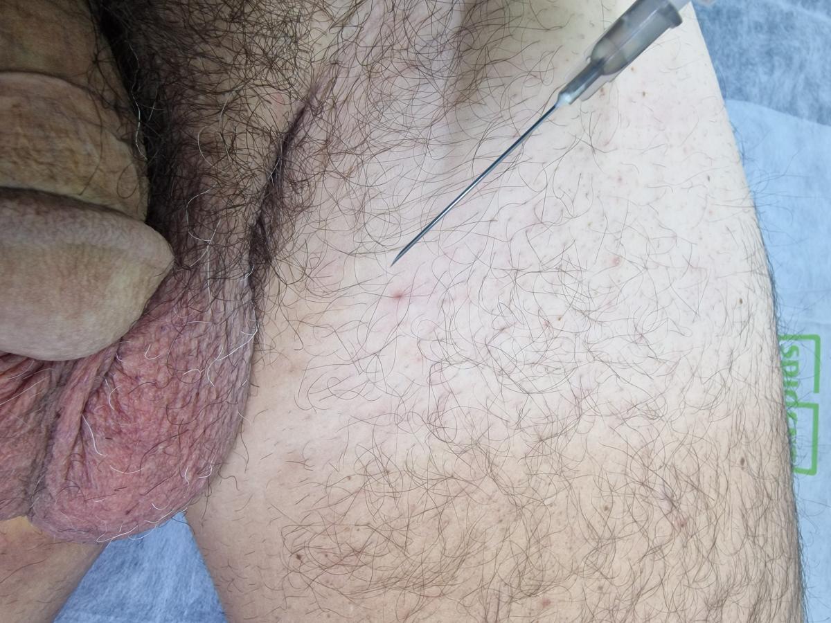 лимфотропное