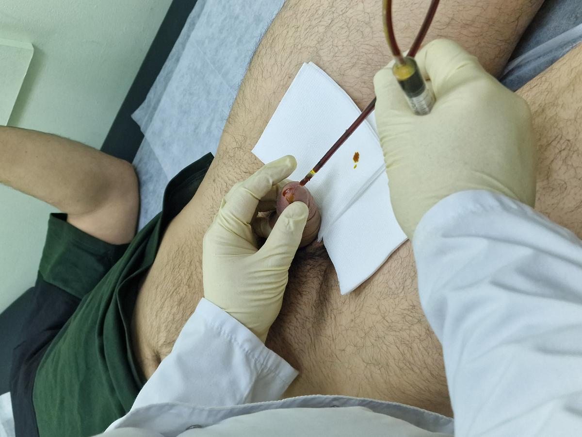 инстилляции