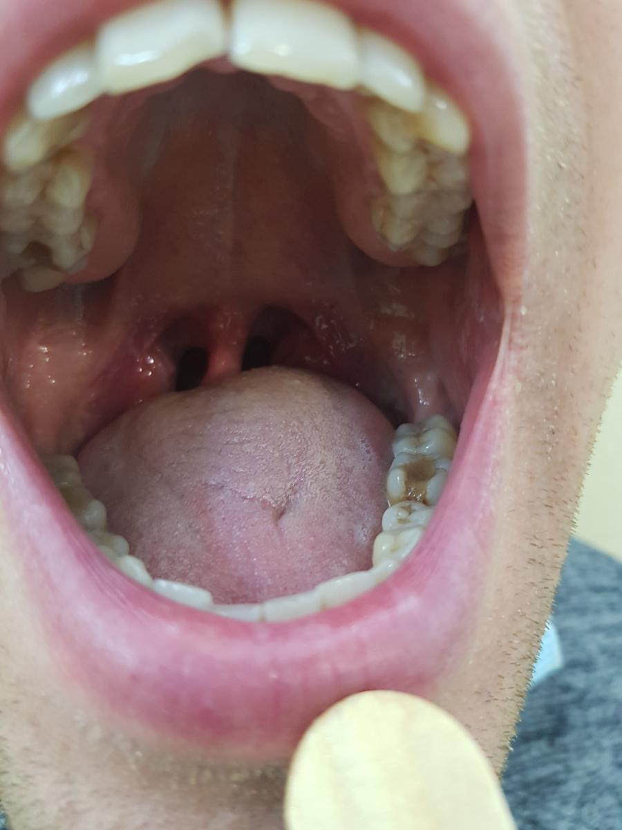 передача хламидиоза воздушно-капельным путём передача хламидиоза