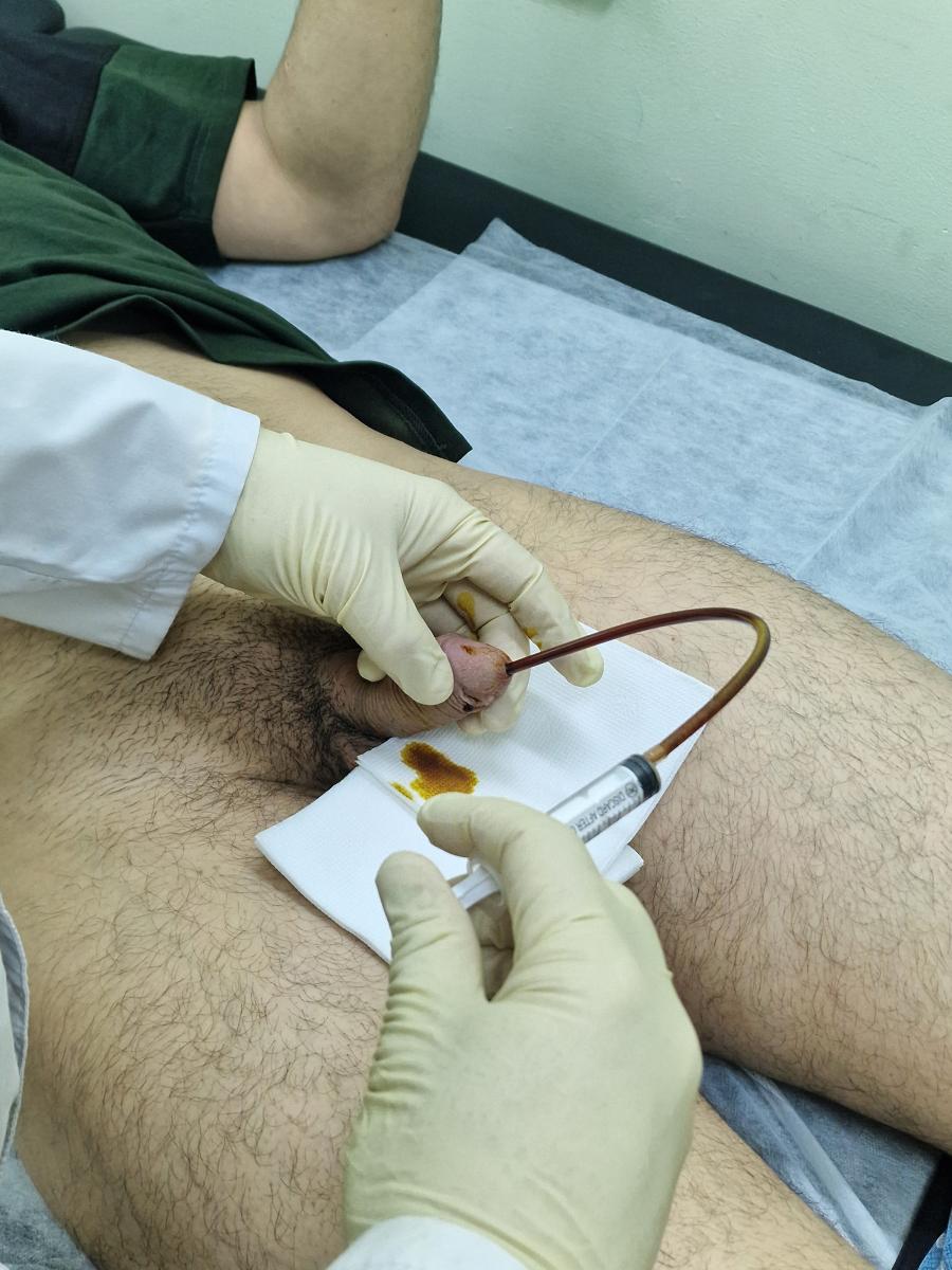 инстилляция