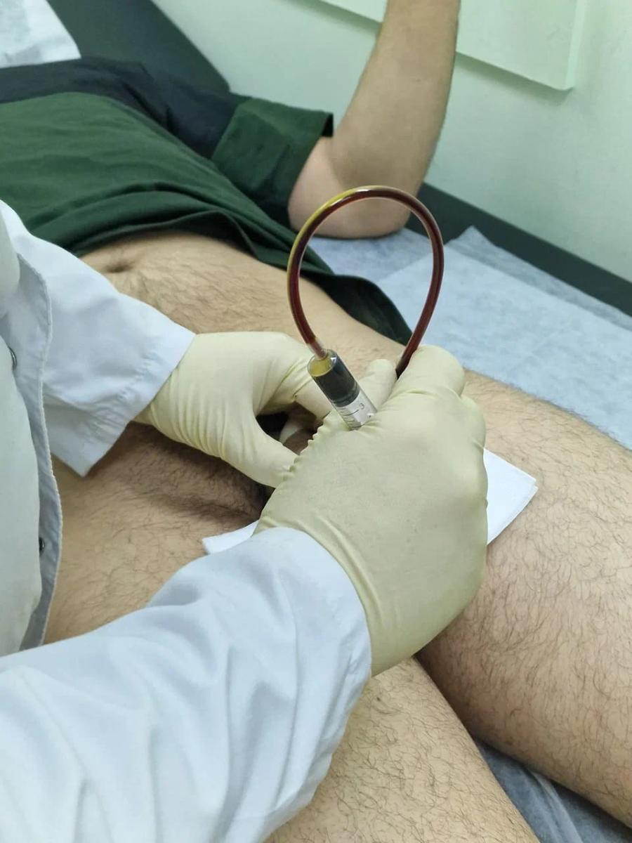 инстилляции уретры