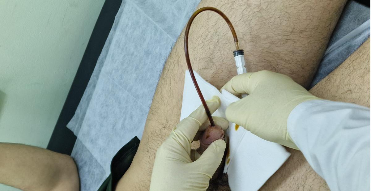 инстилляции в уретру инстилляция