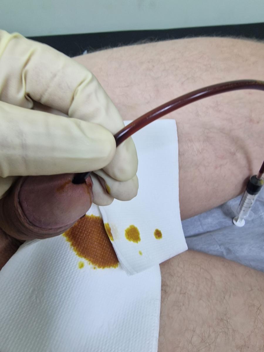 инстилляция