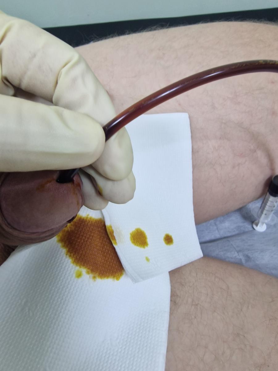 инстилляция