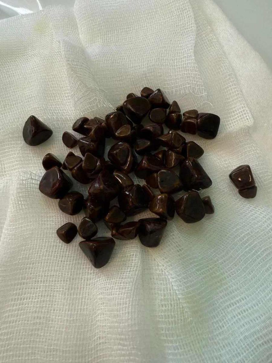 уролитиаз камни в мочевом