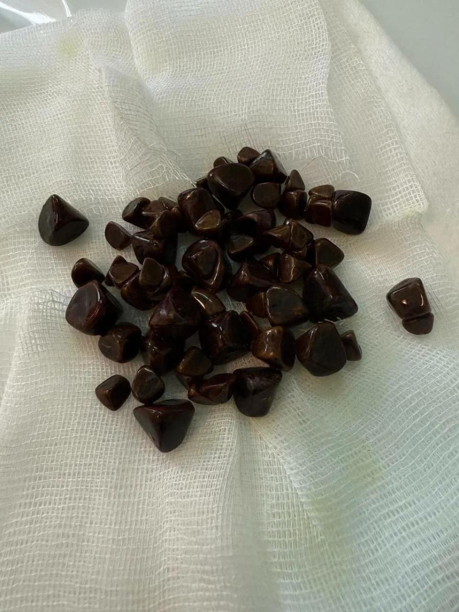 камни в простате