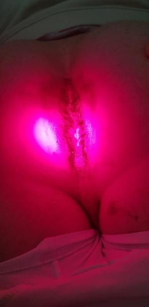 облучение фотодинамическим лазером фотодинамика