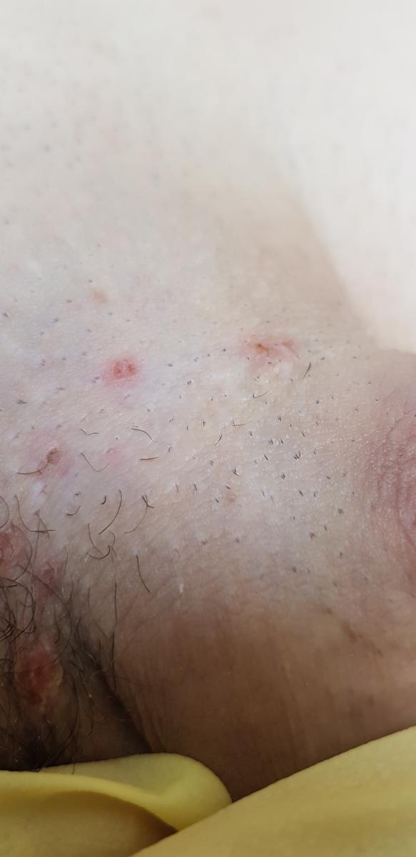 после удаления после