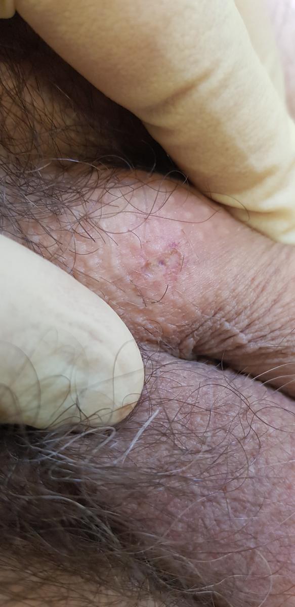 после после