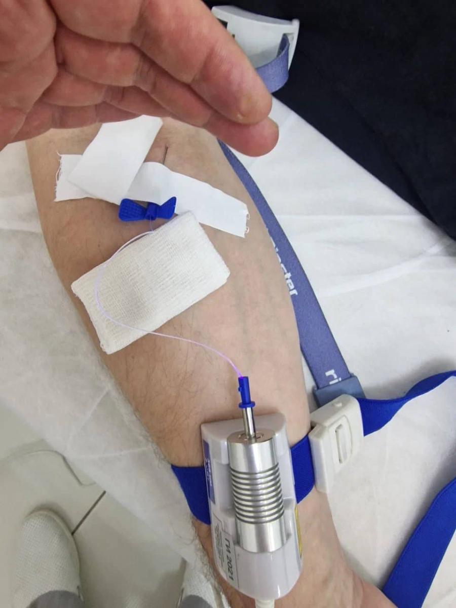 Лазерное и ультрафиолетовое внутривенное облучение крови