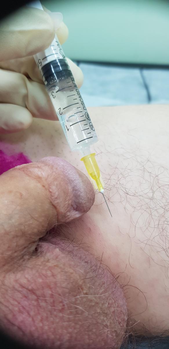 лимфотропное