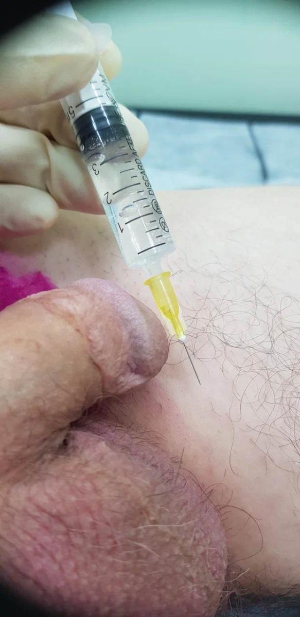 Лимфотропное введение