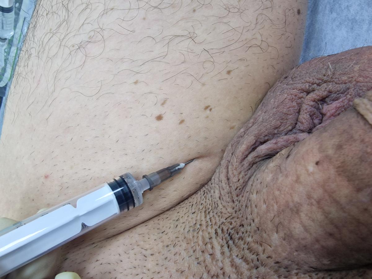 лимфотропное