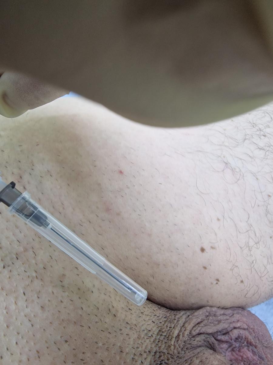 Лимфотропное 