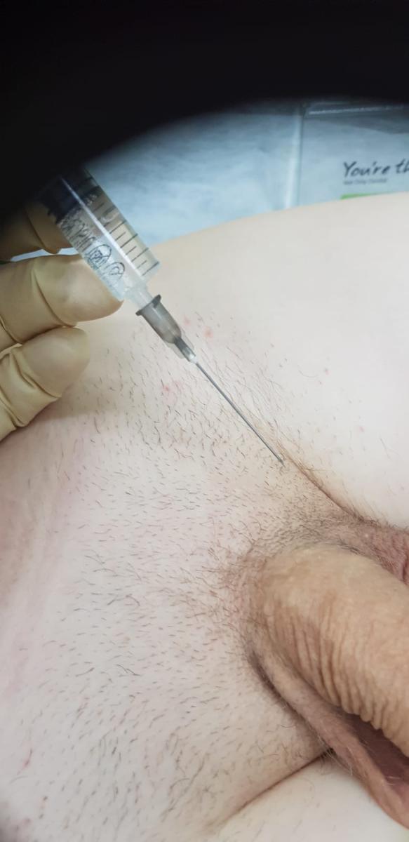 уколы при уреаплазме