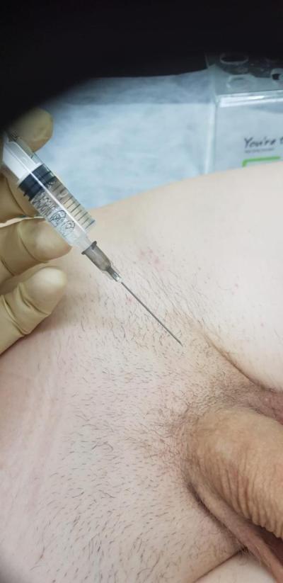 лимфотропная терапия лимфотропная